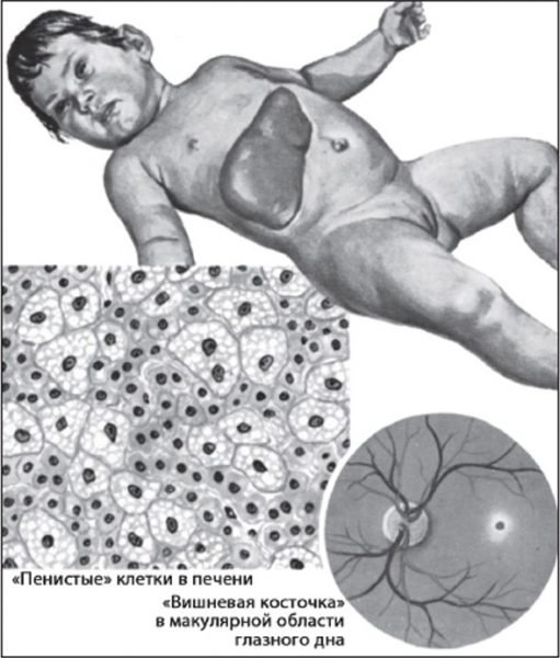Парвовирус у детей - симптомы и лечение, фото и видео