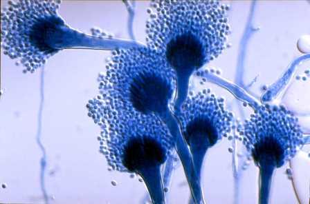 Иммунная система может запускать самоубийство клеток болезнетворных грибов