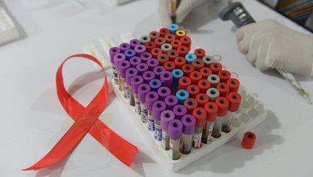 Ученые получили антитела, убивающие 99% штаммов ВИЧ