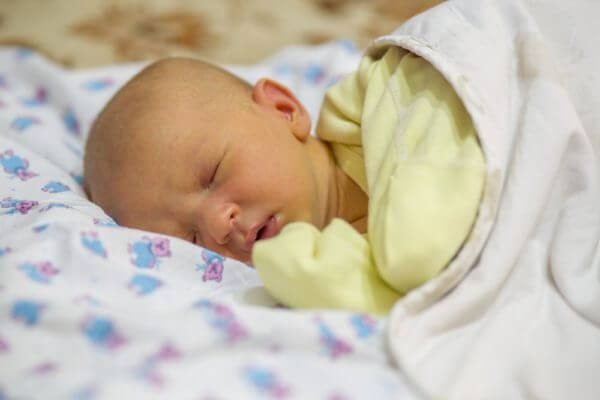 Желтуха у новорожденных – симптомы и лечение, фото и видео. 