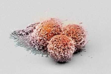 Белок поможет убивать клетки, не позволяющие иммунной системе бороться с раком