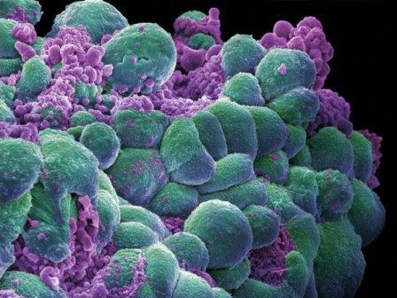 Предложен универсальный десятиминутный тест на раковые заболевания