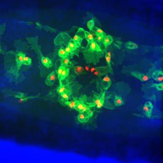 Мертвые клетки препятствуют иммунной реакции
