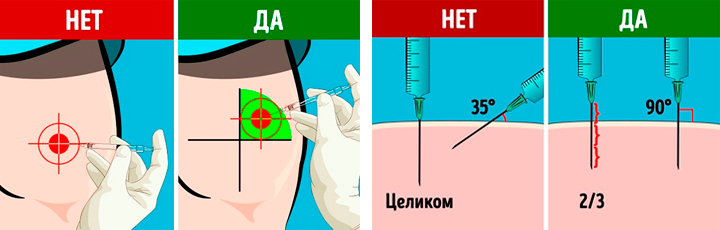 Рисунок куда делать укол в ягодицу